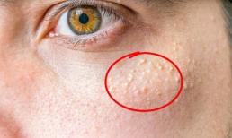 11 dấu hiệu và thói quen hàng ngày khiến bạn già đi nhanh hơn mà bạn không hề nhận ra