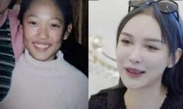 Cô bé 14 tuổi bị mẹ kéo đi phẫu thuật thẩm mỹ, tiêu hơn 3 tỷ trong 15 năm, cư dân mạng: mù quáng vì không có gì cải thiện