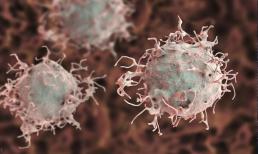 Ung thư đến từ ăn uống, muốn sống lâu nhất quyết không đụng đến 4 loại thực phẩm này, tế bào ung thư sẽ càng xa 