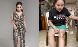 Lê Giang tiết lộ tình hình sức khỏe sau khi mổ chân, đăng luôn ảnh trên bàn mổ