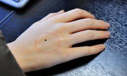 Nốt ruồi trên tay tượng trưng cho điều gì?