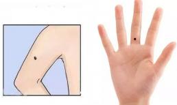 Điểm danh nốt ruồi trên tay tốt hay xấu