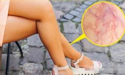 Cạo lông có làm lông dày hơn không? 8 sự thật khoa học đã đánh lừa nhiều người trong nhiều thập kỷ