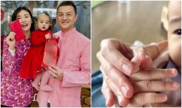 Ngón tay của con gái 1 tuổi mắc bệnh, Lý Á Bằng bị nghi ngờ có vấn đề về gen, vợ Hoa hậu chủ động nhận trách nhiệm 