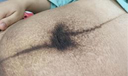 Cận cảnh chiếc bụng sau sinh của 'mẹ bỉm sữa', đấng mày râu nên xem để thương vợ nhiều hơn 