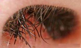 Bất kể nam nữ, lông ba chỗ trên cơ thể đều rất quan trọng, không được tùy ý cạo bỏ, mong các bạn hiểu rõ