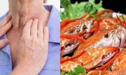 Người đàn ông 35 tuổi viêm họng hóa trị 5 lần chết, bác sĩ quát: Vứt 2 thứ trong tủ lạnh đi