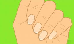 Móng tay của bạn bị gãy hoặc chẻ? Cơ thể bạn đang báo hiệu vấn đề gì? 