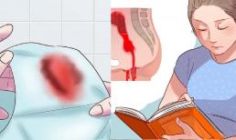 Bà bầu nếu có 7 triệu chứng này mà không đi khám chữa kịp thời, thai nhi rất nguy hiểm, nhớ nhé!