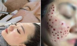 Tiêm meso là gì mà hội chị em đua nhau làm? Những lưu ý cần biết nếu không muốn 'nát mặt' sau tiêm