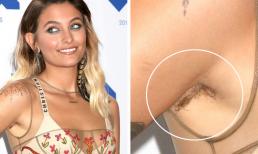 15 người nổi tiếng đã phá vỡ tiêu chuẩn sắc đẹp và không xấu hổ khi phô trương lông trên cơ thể