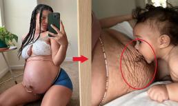 Sự thật phũ phàng về cơ thể phụ nữ sau sinh, xem loạt ảnh của một 'mẹ bỉm sữa' để thấy rõ 