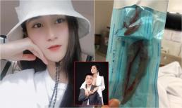 Vợ hot girl của tiền vệ Huy Hùng gây sốc, 'khoe' xương hàm sau khi gọt, dung nhan hiện tại thế nào?