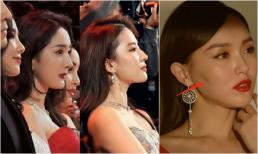 Miệng nhô, cằm nhọn, sống mũi tẹt, khuôn mặt hóp... khuyết điểm quá thật của sao nữ Trung Quốc khi lộ ảnh góc nghiêng