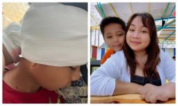 Con trai Kim Đào cấp cứu và khâu hơn 10 mũi khi du lịch Đà Lạt, hành động của nhóc tì dành cho mẹ gây xúc động