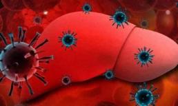 Hai bộ phận cơ thể bị 'ngứa ngáy', rất tiếc phải thông báo rằng gan có thể đã 'sơ cứng', hãy chăm sóc gan thật tốt 