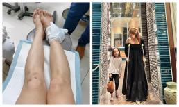Lan Phương chống nạng vì ngã trẹo chân khi làm điều này với con gái