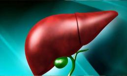 Độc tố trong gan khiến cơ thể ngày càng tồi tệ, và bạn cần làm 4 điều này để thải độc gan