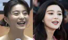 Phạm Băng Băng, Angelababy, Lâm Tâm Như và loạt sao Hoa ngữ 'lột xác' nhan sắc sau khi làm răng 