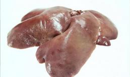 Bệnh nhân xơ gan có ăn được gan lợn không? Nhắc nhở: Để bảo vệ gan, có thể ăn nhiều 3 thực phẩm này