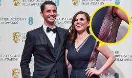 Cách hơn 10 người nổi tiếng xử lý sự cố 'rách váy, hớ hênh' một cách ngoạn mục