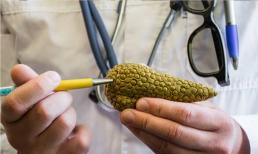 Người đàn ông nấc cụt được chẩn đoán mắc 'vua ung thư'? Những triệu chứng này đang gõ cửa 