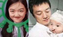 'Con gái hở hàm ếch' của Vương Phi được bố mẹ chi hàng triệu USD phẫu thuật miệng, khuôn mặt ngày càng khác lạ 