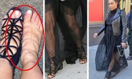 Điểm danh loạt sao nữ đình đám 'hy sinh' vì thời trang, chịu đau để tỏa sáng trong những đôi giày chật chội