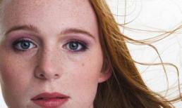 Hướng dẫn chăm sóc da mùa hè: Làm thế nào để tránh sự xuất hiện của các đốm đen trong mùa cao điểm?