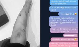 Cô gái ngã xe vì không ôm eo lúc cãi nhau, bạn trai vẫn buông tay và phóng nhanh, dân tình khuyên chia tay gấp 