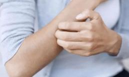 “Ngứa ngáy” 2 nơi trên cơ thể, hay chứng tỏ “đường huyết” đã vượt quá tiêu chuẩn, đừng nghĩ là bệnh ngoài da