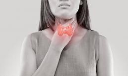 Để phòng ngừa ung thư tuyến giáp, hãy làm 3 điều để giảm tổn thương tuyến giáp và tránh ung thư tuyến giáp 