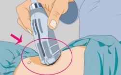 Trong quá trình kiểm tra siêu âm B, luôn có một chất lỏng nhờn dính trên cơ thể, đó là gì? Công dụng của nó là gì?