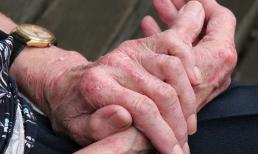 5 vấn đề lớn về da này có thể là do ung thư tìm đến cửa, không thể bỏ qua