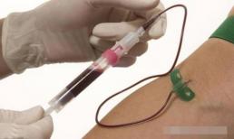 Tại sao bạn phải lấy máu ngay khi vào bệnh viện? Bác sĩ tiết lộ bí mật: máu được rút ra rốt cuộc ở đâu?