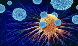 Ai dễ bị ung thư? 8 dấu hiệu báo trước ung thư, 7 việc làm thường ngày có thể phòng tránh