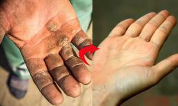 Chai tay, chai chân, dù cứng và thô ráp đến đâu cũng mềm mượt nhờ 6 mẹo, da sẽ mịn màng như 'da em bé' 