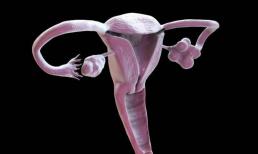 Phụ nữ mắc 'hội chứng âm khổng lồ' vẫn có thể có con? Gợi ý: Tùy vào 4 tình huống, cả nam và nữ nên hiểu