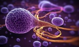 Chỉ có 6 tháng từ khi chẩn đoán đến khi chết! 6 triệu chứng này có thể ung thư tuyến tụy đang 'kêu cứu'