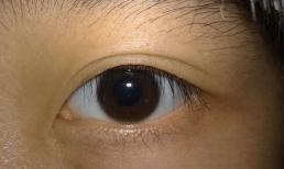 Trong người có ung thư, đôi mắt là 'tiên tri', nếu mắt xuất hiện 3 thay đổi này hãy đến bệnh viện khám càng sớm càng tốt