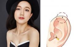 Người có nốt ruồi ở những vị trí này trên mặt thì đường tình duyên tốt đẹp, hôn nhân hạnh phúc, bạn có nốt ruồi nào không?