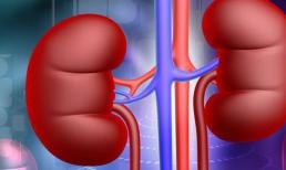 Có 3 dấu hiệu cho thấy thận 'không tốt', nếu bạn không có dấu hiệu nào thì chứng tỏ thận khá khỏe mạnh