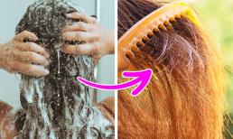 Bao lâu nên gội đầu 1 lần là chuẩn nhất? Bác sĩ nói câu trả lời phụ thuộc vào 3 yếu tố này!