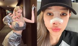 Ngân 98 công khai loạt ảnh sửa mũi lần thứ 8, chia sẻ 'đau dã man' nhưng chỉ có 10 ngày để nghỉ ngơi 