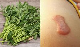 Ăn rau muống sau phẫu thuật và xăm môi dễ gây sẹo lồi? Bác sĩ đưa quan điểm ngược
