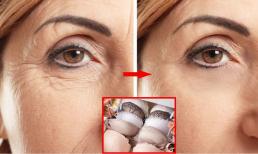 6 lời khuyên khoa học để loại bỏ nếp nhăn, phụ nữ muốn đẹp mà không biết thì thật hối tiếc