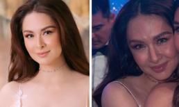 Sự khác biệt của 'Mỹ nhân đẹp nhất Philippines' dưới ống kính thường và hình ảnh đã qua chỉnh sửa