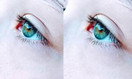 Trong người có ung thư, đôi mắt là tiên tri, nếu mắt xuất hiện 3 thay đổi này, hãy đến bệnh viện khám càng sớm càng tốt