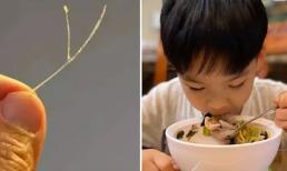 Chữa hóc xương cá bằng cách nuốt miếng cơm lớn là sai, hãy làm theo khoa học, đơn giản mà xương ra tức thì