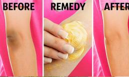 10 thủ thuật tự nhiên để loại bỏ đầu gối và khuỷu tay sẫm màu